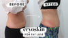 2 Cryoskin Slimming Treatments